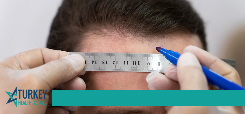 Sapphire Hair Transplant